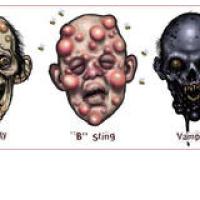 TOREK, NIKOLI NA BOLNI�KI